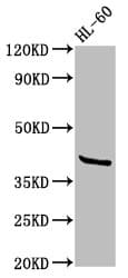 Polyclonal Rabbit anti-Human GPR32 Antibody (IHC, IF, WB)