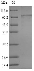 Human ALDH1A3 Protein (Recombinant 6His-SUMO, N-terminus)