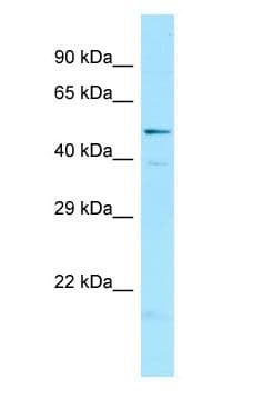 NAPSA / NAPA / Napsin A Antibody (C-Terminus)