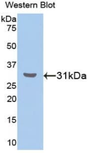 RORA / ROR Alpha Antibody (aa164-401)