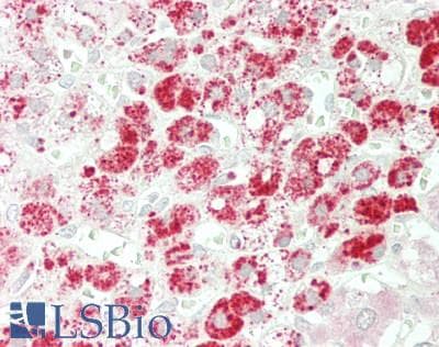 IHC-plus™ GLA / Alpha Galactosidase Antibody (aa81-429)