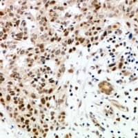 ZNF346 Antibody