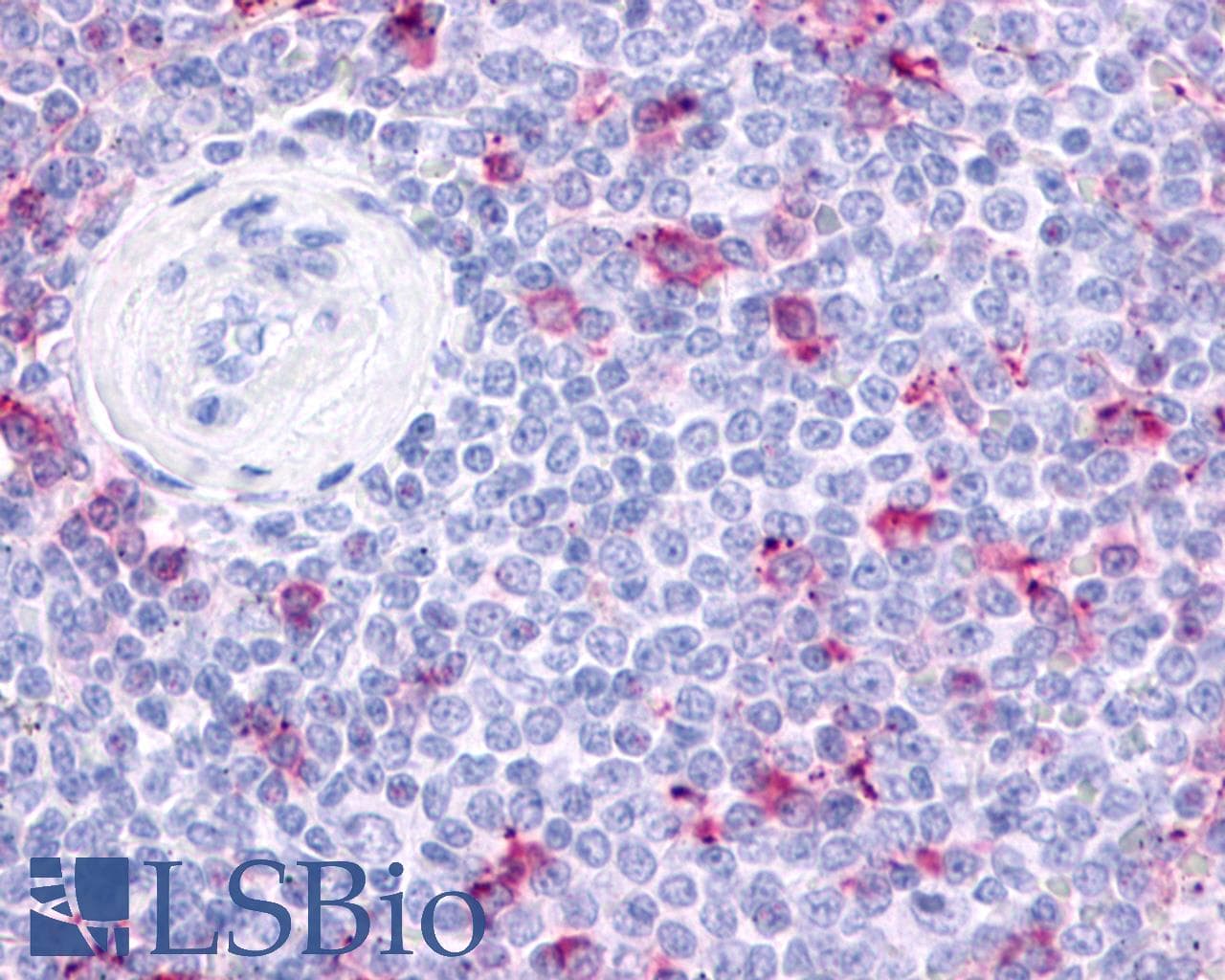 PathPlus™ Polyclonal Rabbit anti-Human GPR34 Antibody (Cytoplasmic Domain, IHC)