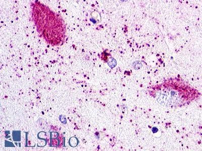 PathPlus™ Polyclonal Rabbit anti-Human ACKR2 / CCR10 / D6 Antibody (N-Terminus, IHC)