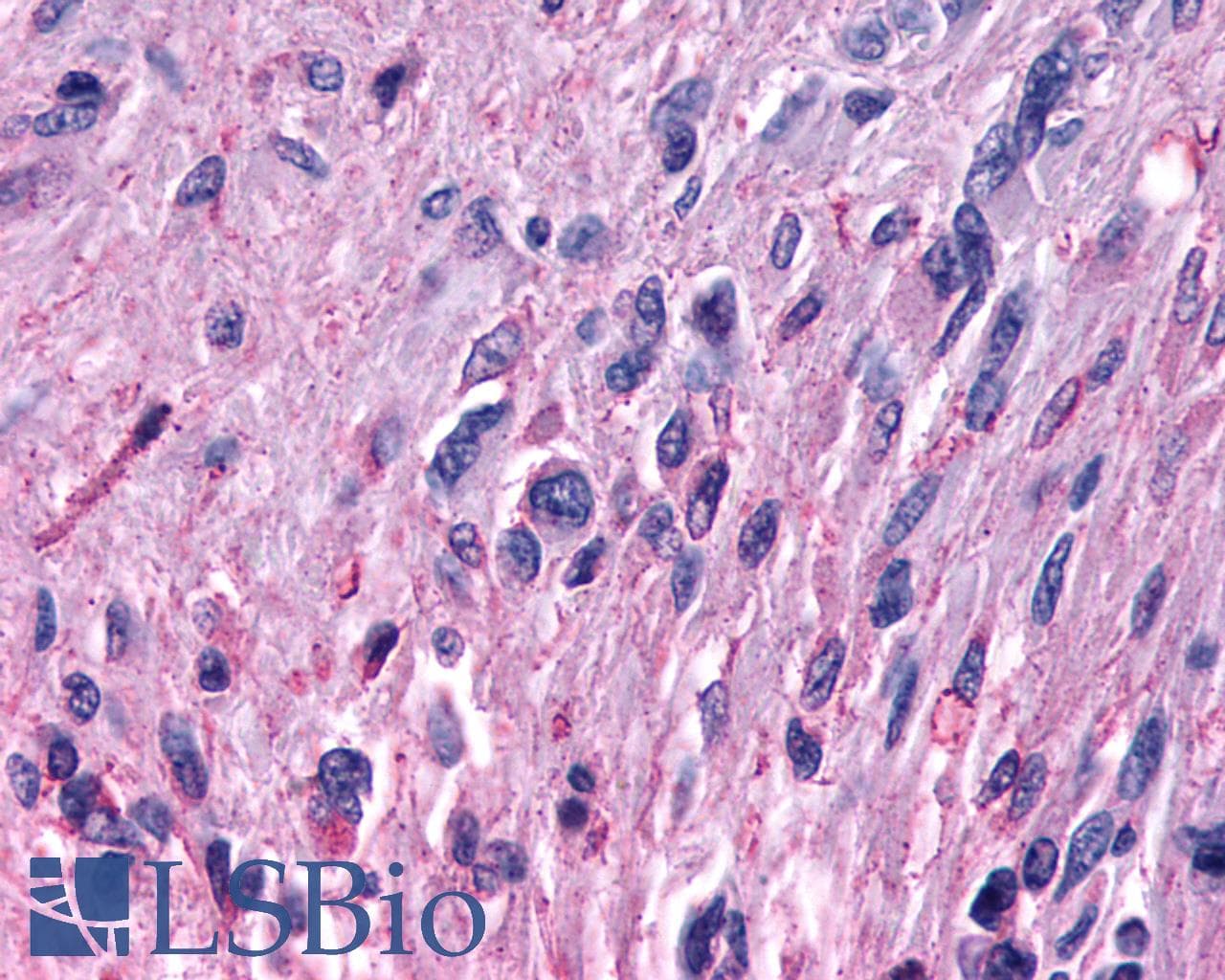 PathPlus™ MRGPRF Antibody (N-Terminus)