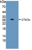 TG / Thyroglobulin Antibody (aa2418-2660)