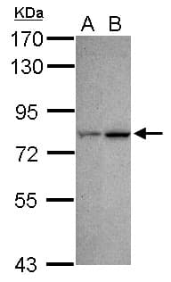 CDYL Antibody