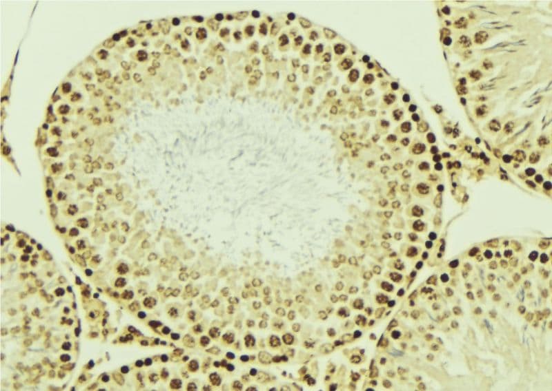 Polyclonal Rabbit anti-Human LIG4 / DNA Ligase IV Antibody (IHC, IF, WB)