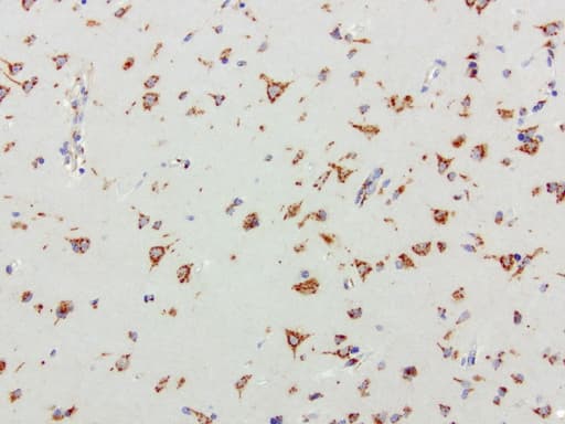 Monoclonal Mouse anti-Human SQSTM1 Antibody (clone UMAB12, Carrier-free, IHC, IF, WB)