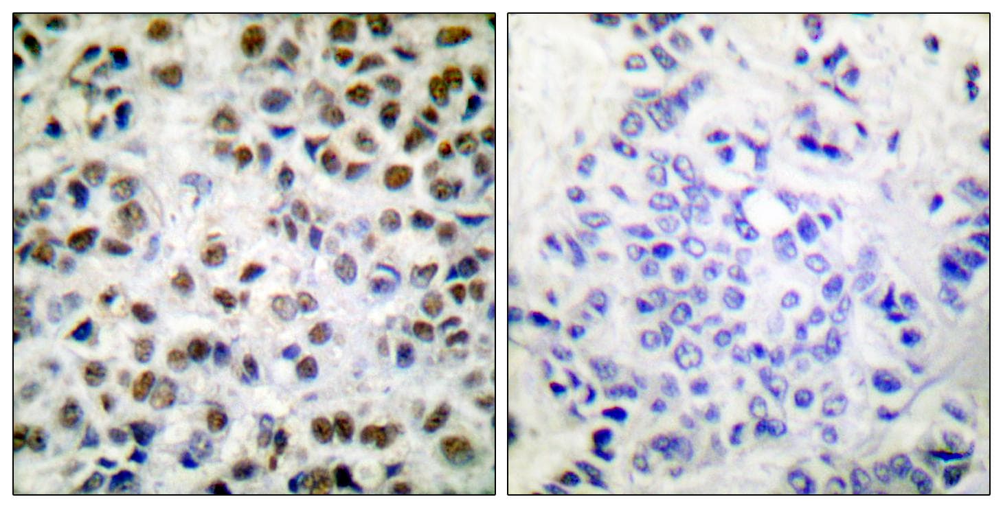 Polyclonal Rabbit anti-Human POLR2A / RNA polymerase II Antibody (phospho-Ser1619, IHC, IF, WB)