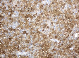 TP / Thymidine Phosphorylase Antibody (aa311-482, clone OTI1E7, Carrier-free)