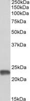 PathPlus™ SOD2 / Mn SOD Antibody (aa77-91)