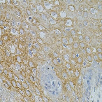 NTF3 / Neurotrophin 3 Antibody