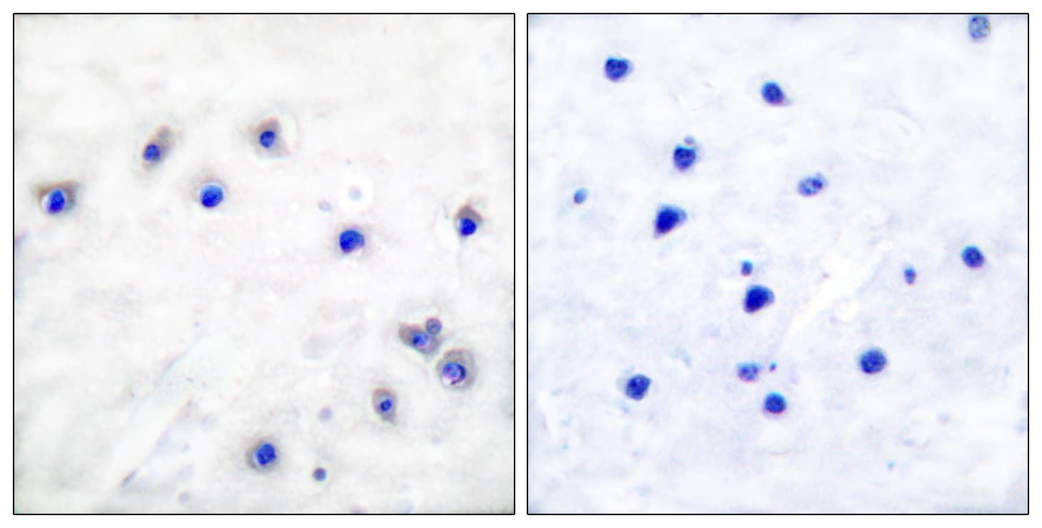 TH / Tyrosine Hydroxylase Antibody (phospho-Ser19)