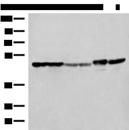 Polyclonal Rabbit anti-Human FLOT2 / Flotillin 2 Antibody (IHC, WB)