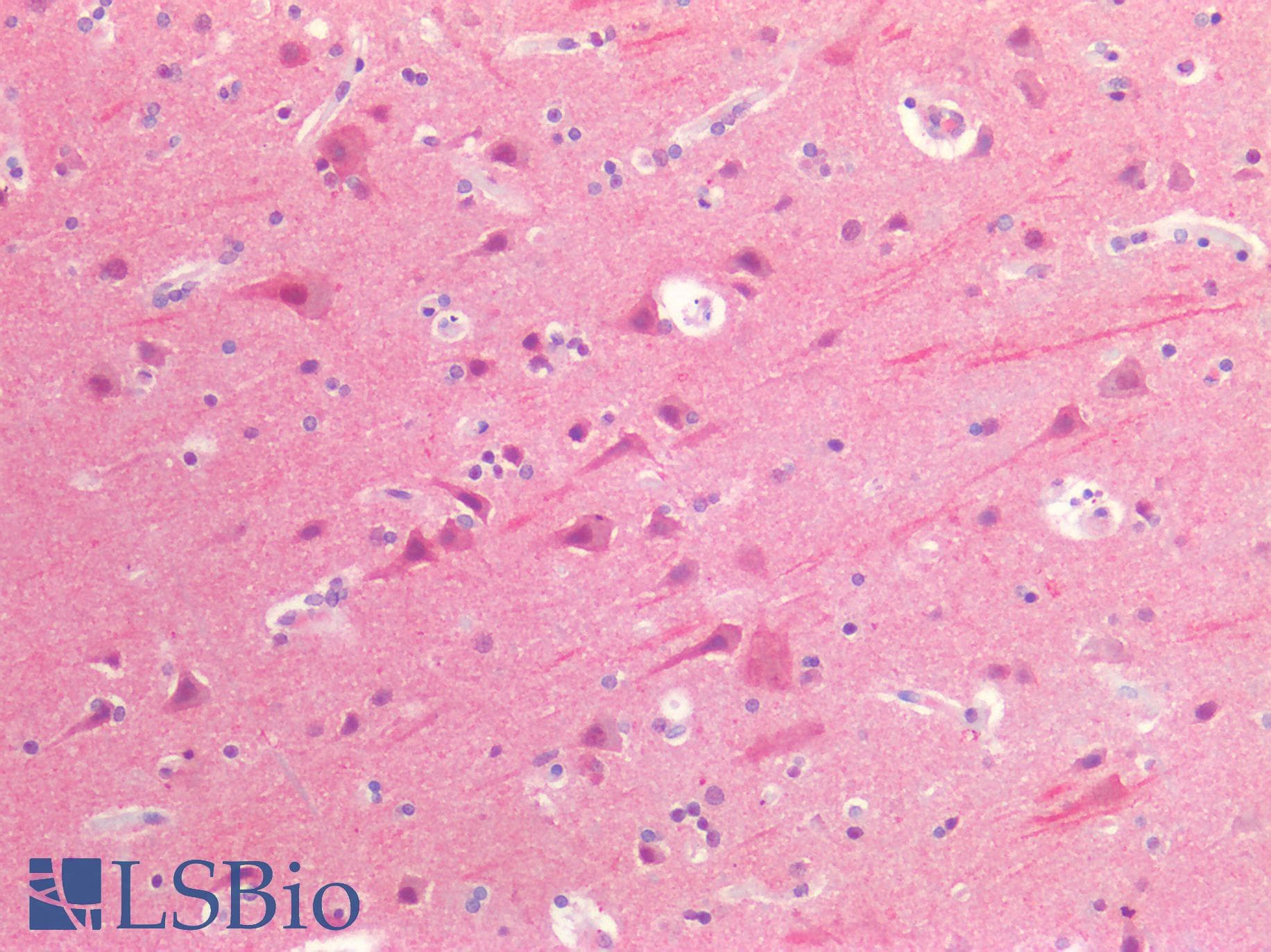 IHC-plus™ ACHE / Acetylcholinesterase Antibody