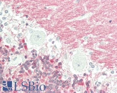 IHC-plus™ VILIP / VSNL1 Antibody (aa2-191, clone 2D5)