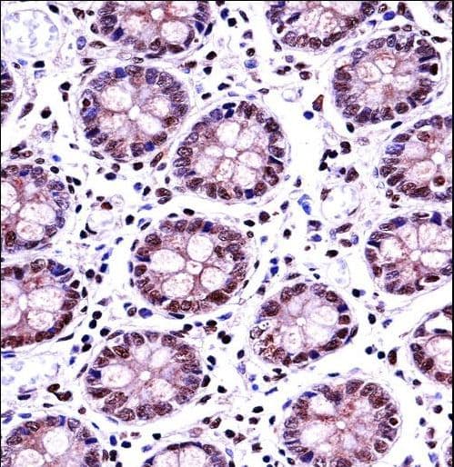 Polyclonal Rabbit anti-Human TERF2 / TRF2 Antibody (aa308-337, IHC, WB)