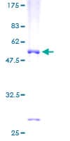 Human WBSCR22 Protein (Recombinant GST)