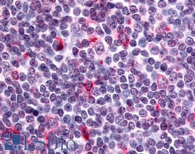IHC-plus™ CXCR6 Antibody (C-Terminus)
