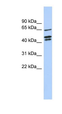 ZNF578 Antibody (aa107-156)