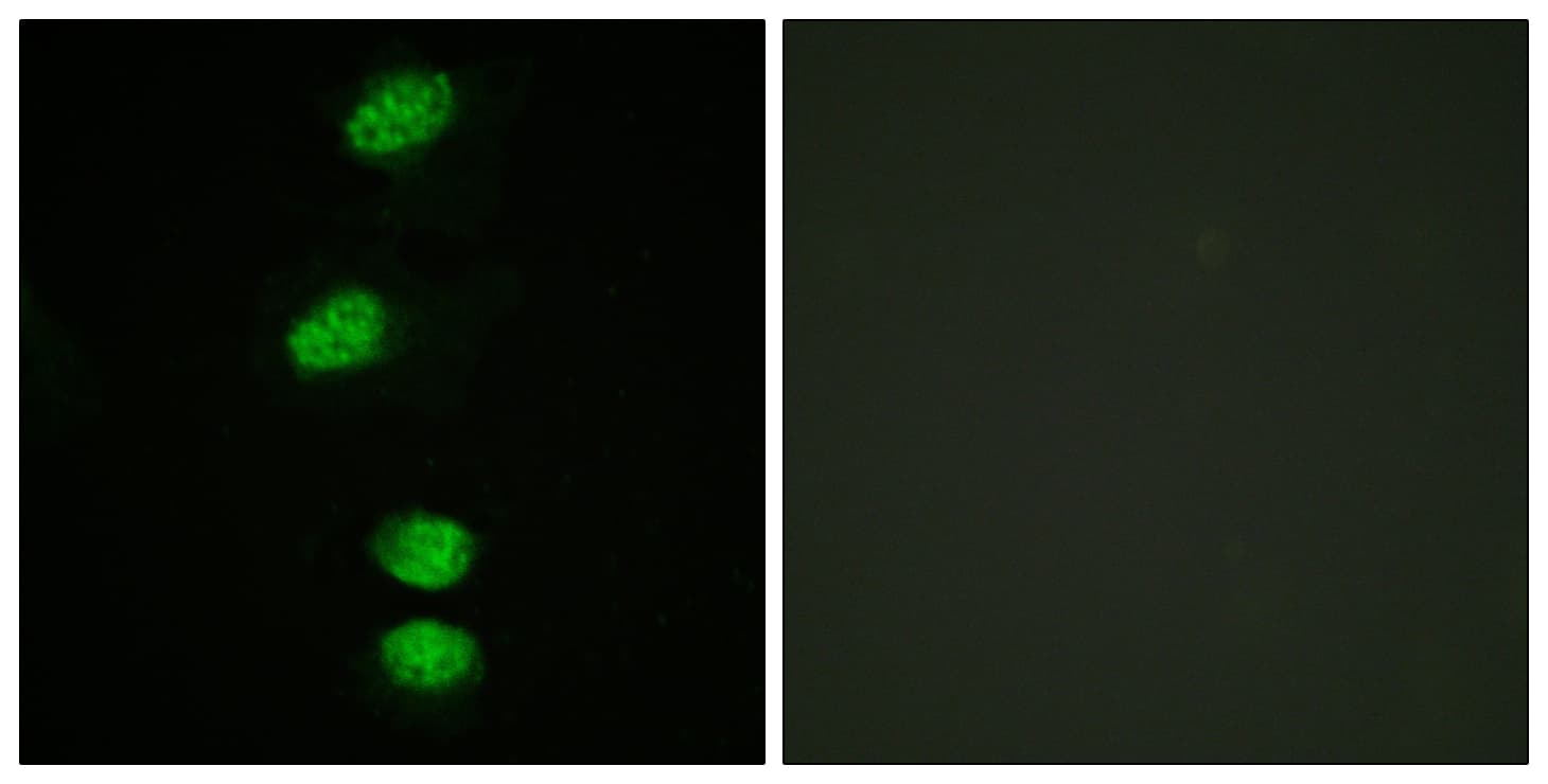Polyclonal Rabbit anti-Human AR / Androgen Receptor Antibody (phospho-Ser94, IF)