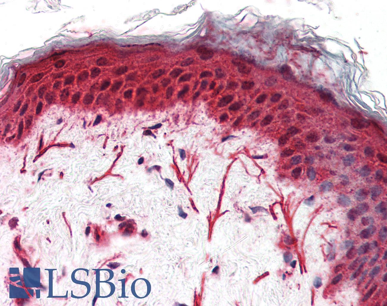IHC-plus™ FZD3 / Frizzled 3 Antibody (N-Terminus)