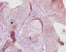 Ces1c / Carboxylesterase 1C Antibody