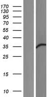 FKBP5 / FKBP51 Protein (Over-Expression Lysate Myc-DDK (Flag))