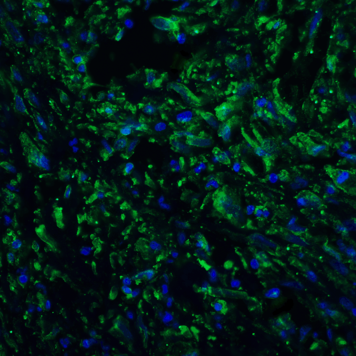 IHC-plus™ Monoclonal Mouse anti-Human PD-L2 / PDCD1LG2 / CD273 Antibody (clone 7C7, IHC, IF, WB)