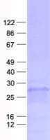 Human TFPI2 Protein (Recombinant His, N-Terminal)