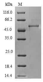 Human CHMP4B Protein (Recombinant GST, N-terminus)