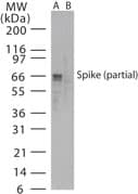 SARS-CoV Spike Glycoprotein Antibody (aa288-303)