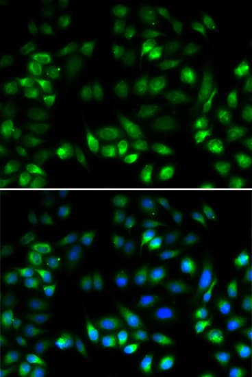 IHC-plus™ MANF / ARMET Antibody