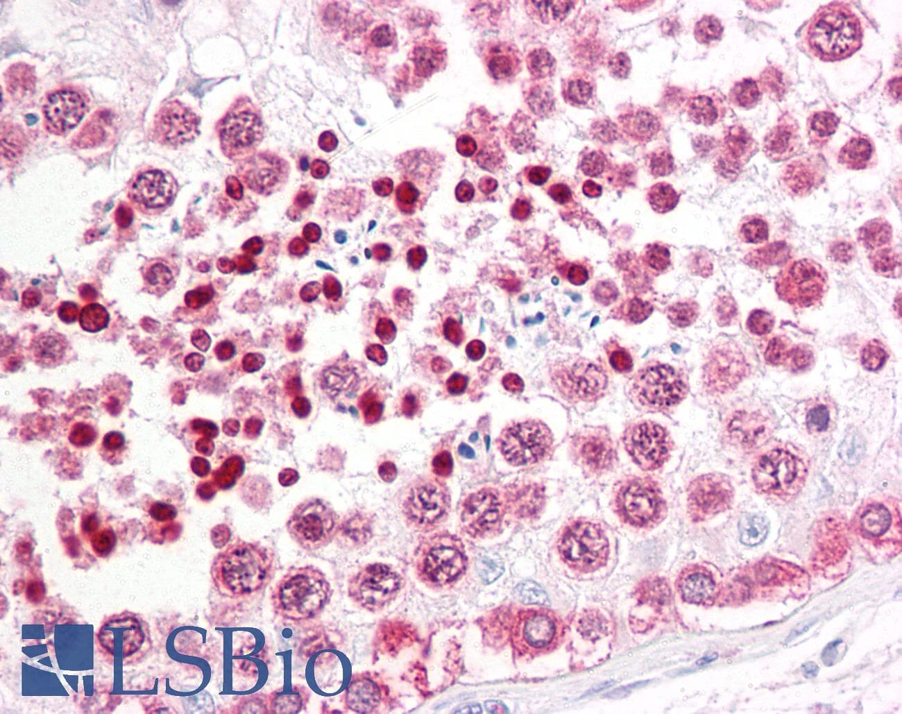 IHC-plus™ INADL / PATJ Antibody (aa2-14)
