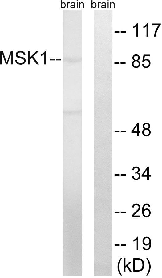 RPS6KA5 / MSK1 Antibody (Ab-212)