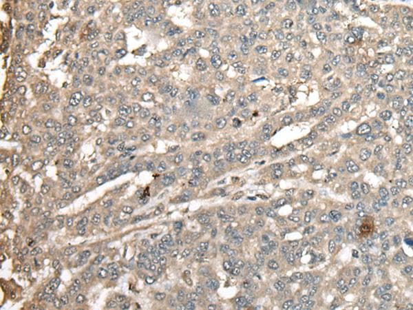 ATXN3 / JOS Antibody