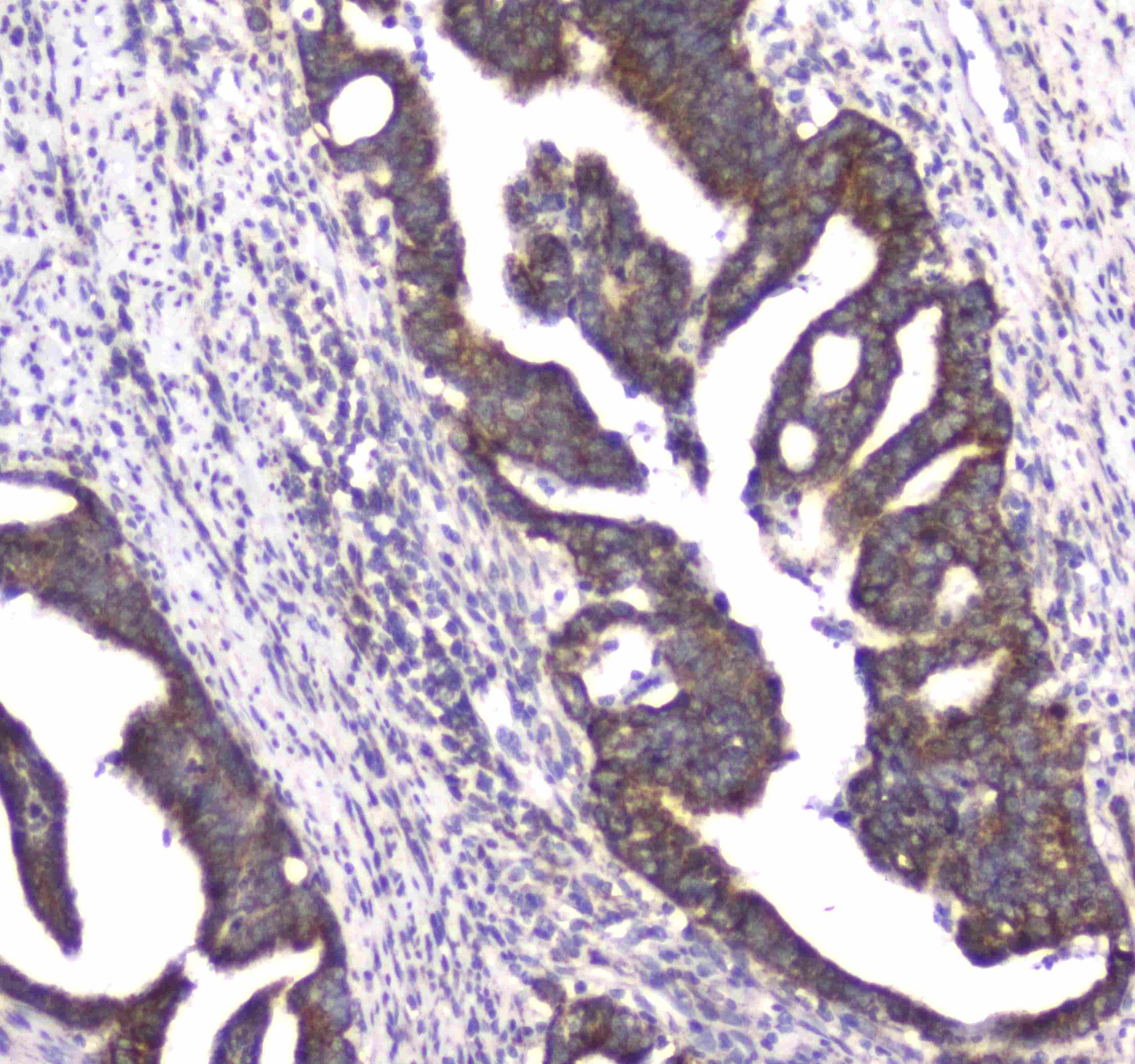 CLPX Antibody