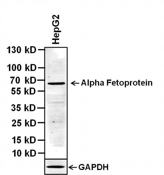 Alpha-Fetoprotein Antibody (clone P5B8)
