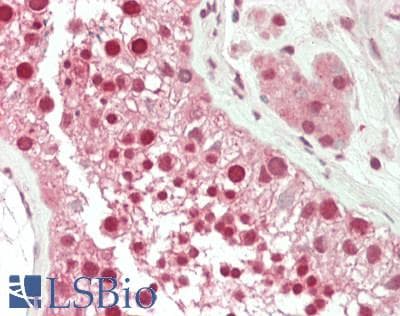 IHC-plus™ EIF4A2 Antibody (aa1-407)