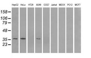 IHC-plus™ Monoclonal Mouse anti-Human AKR1A1 Antibody (clone 10E11, IHC, WB)
