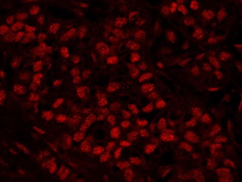 HFip1 / FIP1L1 Antibody (aa544-594)