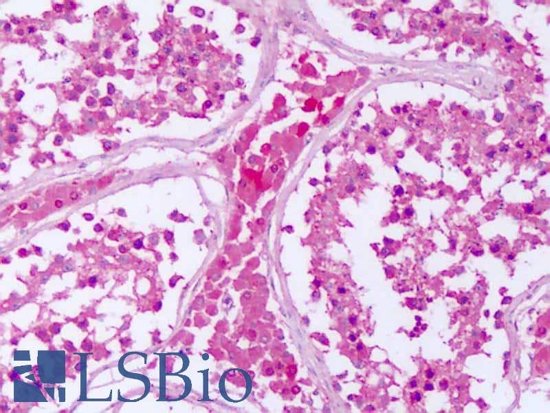 IHC-plus™ PTPRE / PTP Epsilon Antibody (Cytoplasmic Domain)