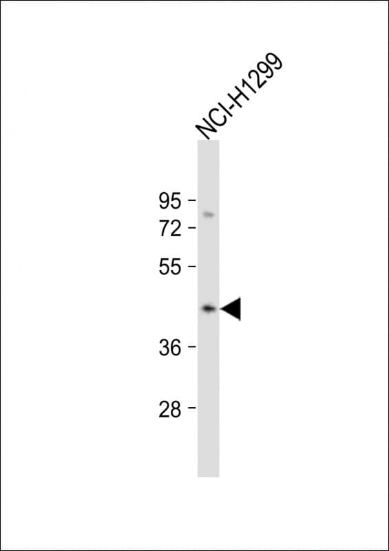CSNK2A3 / CSNK2A1P Antibody (aa19-52)