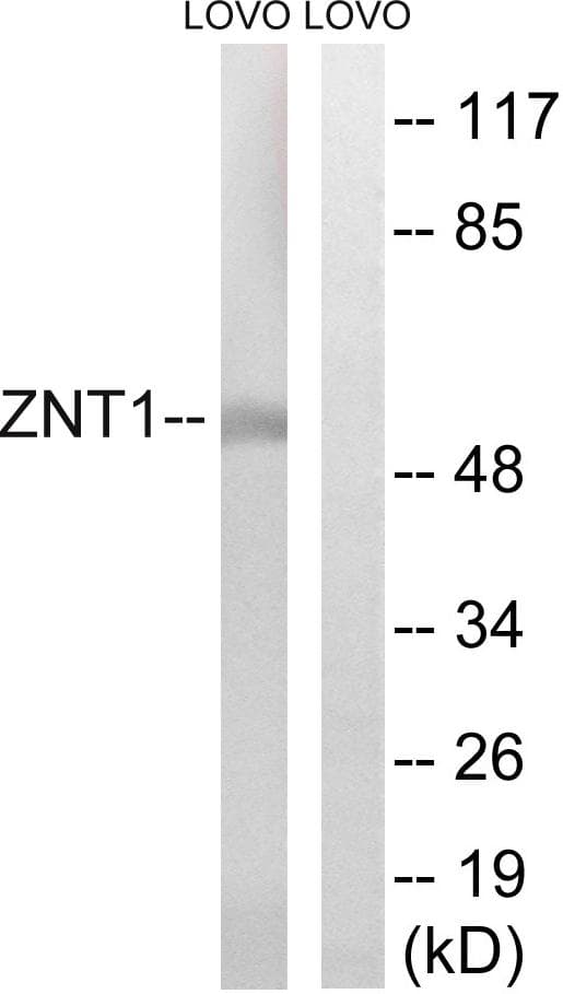 SLC30A1 / ZNT1 Antibody
