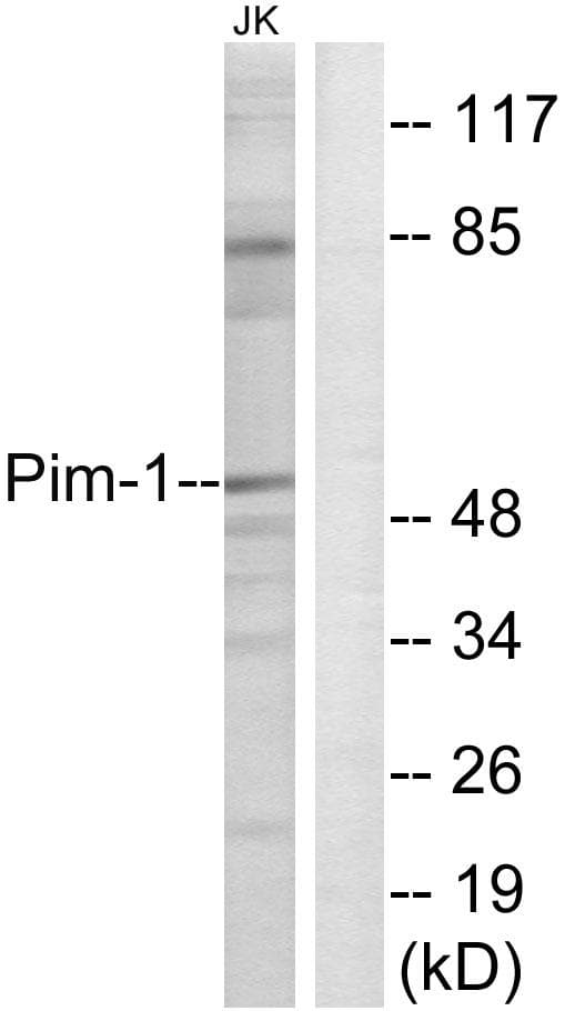 PIM1 / Pim-1 Antibody (p309)