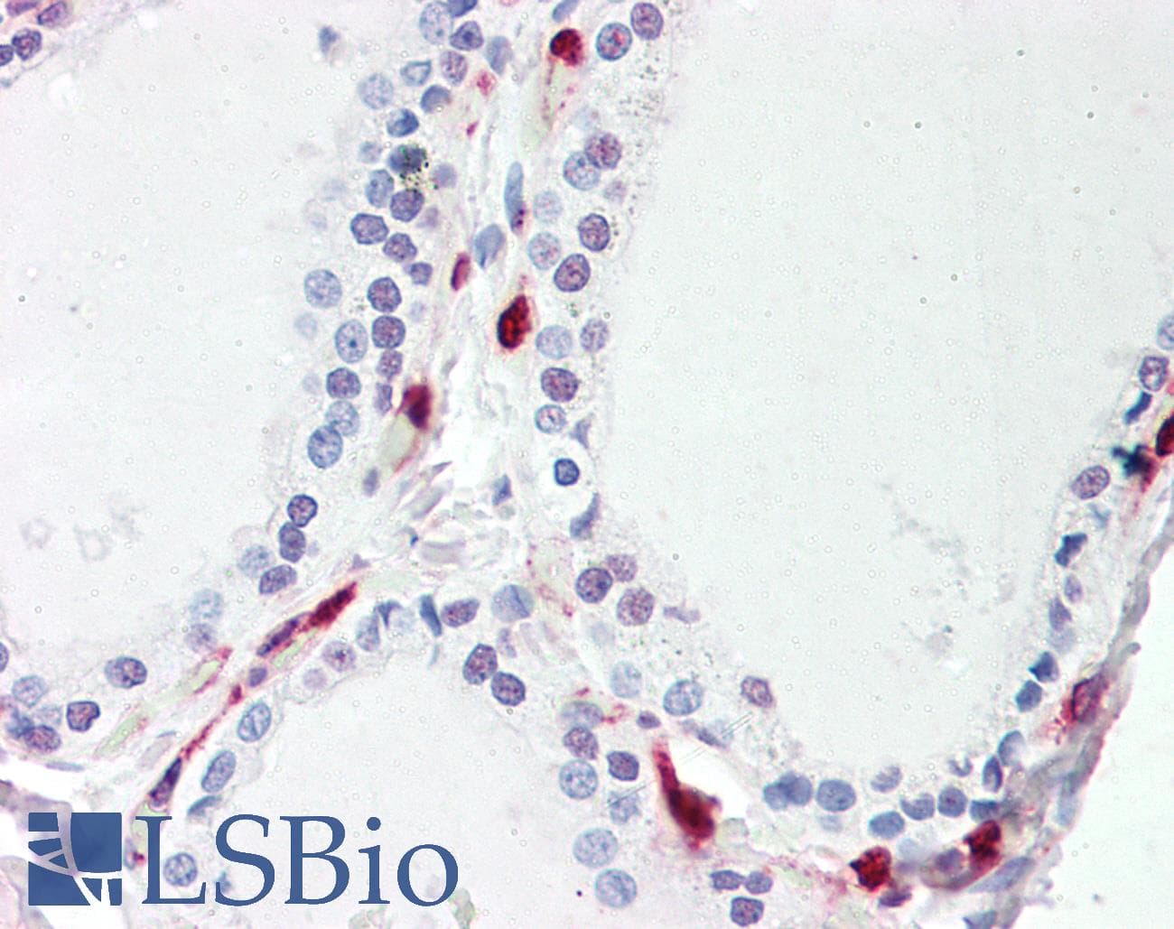 IHC-plus™ ATP13A1 Antibody (aa956-968)