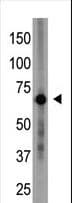 CRY1 Antibody (aa556-586)