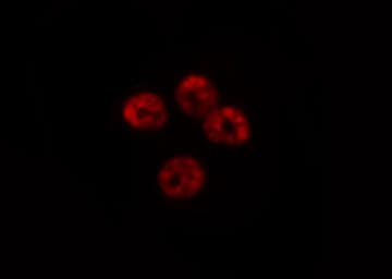 Polyclonal Rabbit anti-Human HEC1 / NDC80 Antibody (C-terminal, IHC, IF, WB)