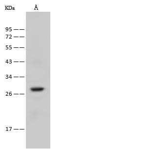 Polyclonal Rabbit anti-Human RAB38 Antibody (WB)